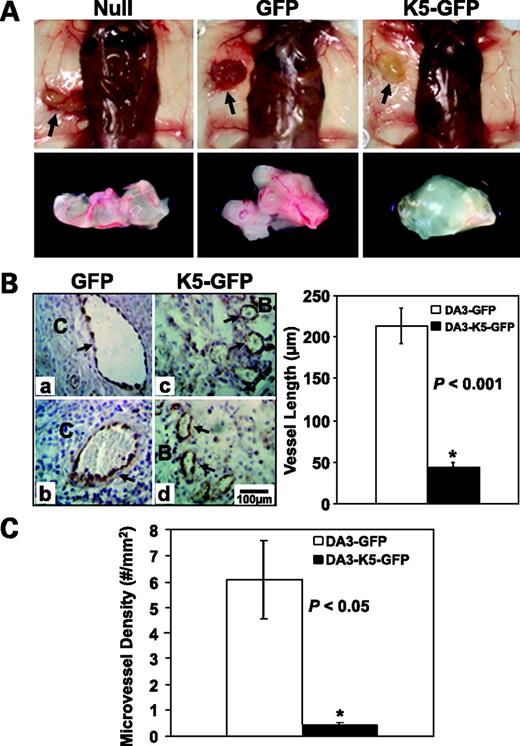 Figure 4. hK5His acts as a potent antiangiogenic agent. A, implant (arrow) retrieval 1 wk after implantation of 106 Matrigel: embedded DA/3 (n = 4), DA/3-GFP (n = 4), or DA/3-hK5His-GFP (n = 4) cells (representative images at the same magnification). B, left, representative images of von Willebrand factor–positive immunostained blood vessels (black arrows) from two different DA/3-GFP–containing (a and b) and DA/3-hK5His-GFP–containing (c and d) implants. C, center of implant. B, border of implant. Magnification, ×160. Right, columns, mean von Willebrand factor–positive vessel length (μm) for both experimental groups; bars, SE. C, columns, mean number of von Willebrand factor–positive blood vessels divided by the mean section surface area (microvessel density; mm2); bars, SE. Statistical analysis was done using Student's t test.