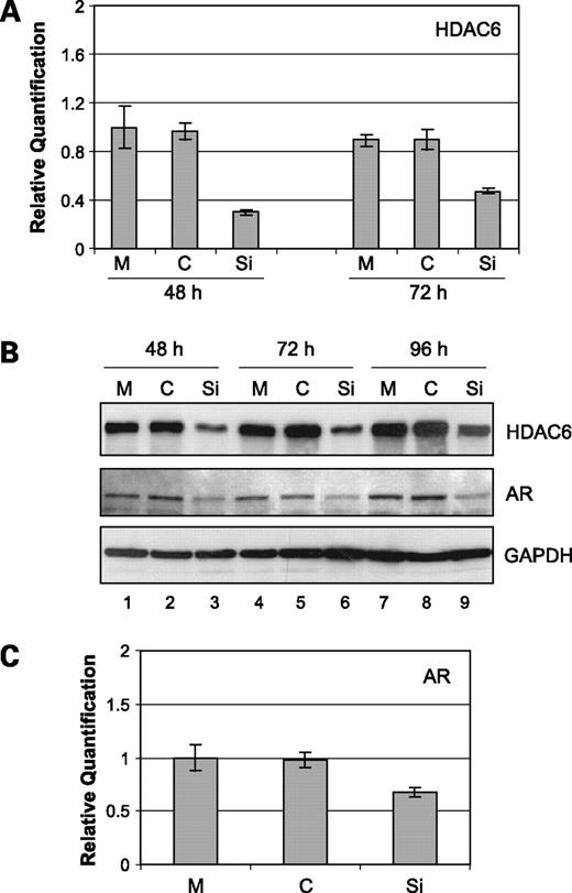 Figure 4. Effect of HDAC6 knockdown on AR. A, a siRNA specific for HDAC6 (Si), a nonspecific control siRNA (C), or mock (M)-transfected LNCaP cells for the indicated periods were used for the quantification of HDAC6 mRNA levels by real-time PCR. Average of one representative experiment done in quadruplicate; bars, SE. B, Western blot analysis showing the levels of HDAC6 and AR in HDAC6 knockdown LNCaP cells for the specified time points. Nonspecific control siRNA and mock-transfected LNCaP cells are indicated. Glyceraldehyde 3-phosphate dehydrogenase was used as a loading control. C, quantification of AR mRNA levels in HDAC6 siRNA, nonspecific control siRNA, or mock-transfected LNCaP cells at 48 h. Average of one representative experiment done in quadruplicate; bars, SE.