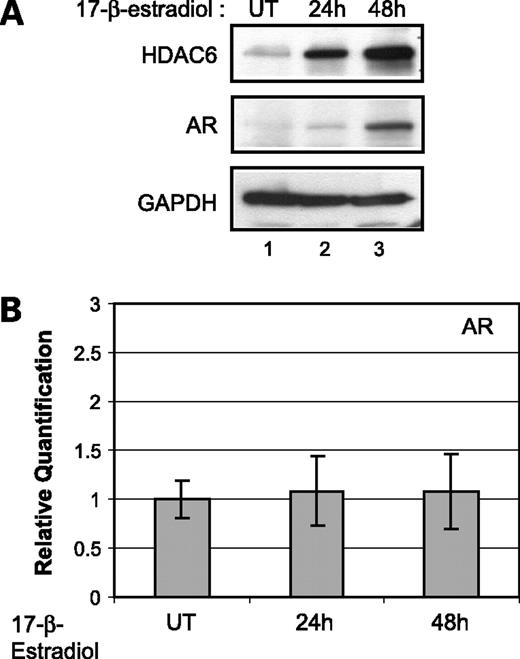 Figure 5. Effect of 17β-estradiol on HDAC6 and AR. A, Western blot analysis showing HDAC6 and AR protein levels in LNCaP cells untreated and treated with 1 nmol/L 17β-estradiol for the indicated periods. Glyceraldehyde 3-phosphate dehydrogenase was used as a loading control. B, quantification of AR mRNA levels by real-time PCR in untreated and 1 nmol/L 17β-estradiol-treated LNCaP cells for the indicated periods. Average of one representative experiment done in quadruplicate; bars, SE.
