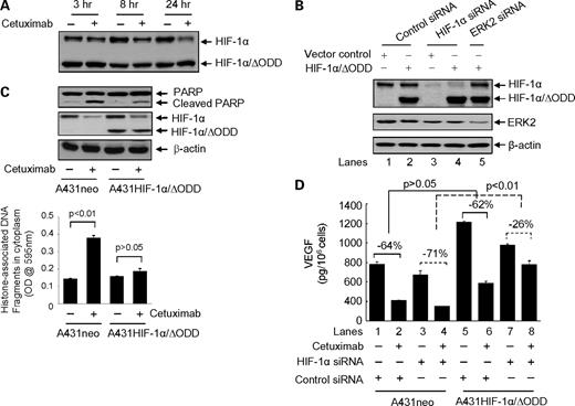 Figure 3. Down-regulation of HIF-1α is a major antitumor mechanism of cetuximab. A, A431 cells were transiently transfected with a HIF-1α/ΔODD construct for 24 h followed by exposure to 10 nmol/L cetuximab for the indicated periods. Cell lysates were prepared at each time point for Western blot analysis with a HIF-1α antibody as described in Fig. 1. B, A431 cells were transiently transfected with the HIF-1α/ΔODD or a control vector (pcDNA3.1) along with a scrambled siRNA (negative control siRNA), an ERK2-siRNA (positive control siRNA), and a HIF-1α ODD-targeting siRNA as indicated. Seventy-two hours after the transfection, the cell lysates were prepared and subjected to Western blot analysis with the indicated antibodies. C, A431 cells were transiently transfected with either the HIF-1α/ΔODD construct or control vector (pcDNA3.1) for 24 h followed by a 16-h culture without or with 10 nmol/L cetuximab. The cells were then harvested for measuring the cleavage of PARP by Western blot analysis (top) and for quantifying the levels of histone-associated DNA fragmentation in the cytoplasm on cetuximab treatment by ELISA (bottom). The expression of HIF-1α/ΔODD construct was measured as described in A. The levels of β-actin served as an internal control for equal protein loading in each lane. D, A431 cells were transiently transfected with the HIF-1α/ΔODD construct or control vector (pcDNA3.1) along with the HIF-1α ODD-targeting siRNA or scrambled siRNA for 72 h. The cells were cultured with or without 10 nmol/L cetuximab for 24 h, and the VEGF secreted into the conditioned media by the cells was measured by ELISA. P values for the comparisons shown were determined by Student's t test.