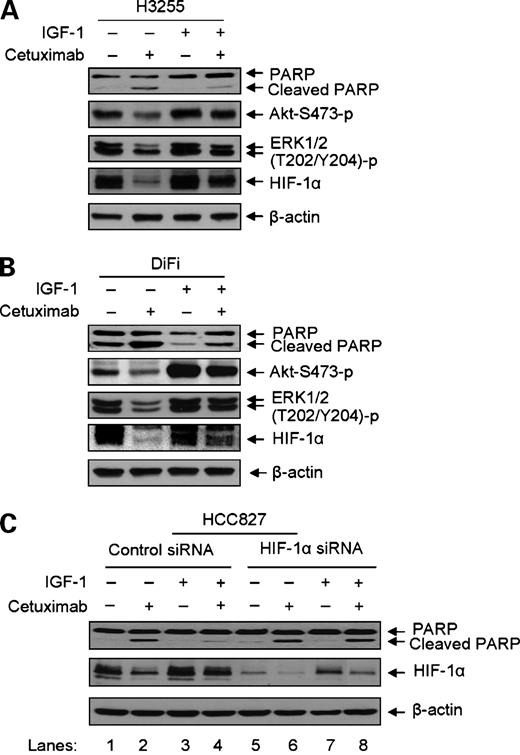 Figure 5. Effect of HIF-1α silencing on reversing IGF-I-mediated protection against cetuximab-induced PARP cleavage. A and B, H3255 and DiFi cells were left untreated or treated with 10 nmol/L cetuximab with or without concurrent treatment with 10 nmol/L IGF-I overnight (16 h) as indicated. The cells were lysed, and equal amounts of cell lysates were subjected to Western blot analysis using the antibodies indicated. C, HCC827 cells were first subjected to a 72-h culture period after transfection with a scrambled or HIF-1α-specific siRNA. The cells were then left untreated or treated with 10 nmol/L cetuximab with or without concurrent treatment with 10 nmol/L IGF-I overnight as in A and B. The cells were lysed, and equal amounts of cell lysates were subjected to Western blot analysis using the antibodies indicated. The levels of β-actin served as an internal control for equal protein loading in each lane.