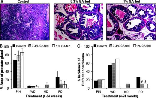 Figure 3. Inhibitory effect of gallic acid feeding on prostate tumorigenesis in TRAMP mice. At the time of necropsy, after 20 wk of gallic acid feeding, starting from the fourth week of age, each mouse was weighed and the LUT, including the bladder, seminal vesicles, and prostate, was removed en bloc. The dorsolateral prostate gland was histopathologically analyzed for the different stages of the neoplastic progression. A, photomicrographs (magnification, ×100) representative of a treatment group show the H&E staining of the dorsolateral prostate of positive control and gallic acid–fed mice sacrificed after 24 wk of age. B, percentage of area of prostate gland of positive control and gallic acid–fed groups having histologically diagnosed PIN, well-differentiated, moderately differentiated (MD), and poorly differentiated (PD) adenocarcinoma characteristics. Bars, SE. The statistical significance of difference between the specific pathologic states of positive control and gallic acid–fed groups was analyzed by unpaired two-tailed Student's t test. P values < 0.05 were considered significant. C, effect of gallic acid feeding on the incidence of PIN/adenocarcinoma lesions in TRAMP mice. Fisher's exact test was used to compare incidence of PIN and adenocarcinoma in positive control versus gallic acid–fed groups. P values <0.05 were considered significant. #, P < 0.01.