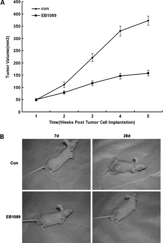 Figure 2. Effects of EB1089 on the growth of HEp-2 cells in vivo in an early tumor model. Nude mice aged 6 wk were used. HEp-2 cells were injected s.c. into the flanks of each mouse to initiate tumor growth. Animals were treated i.p. with either saline and ethanol vehicle or EB1089 (0.20 μg/kg) for 5 d each week for 5 wk as indicated in Materials and Methods. Tumor sizes were measured weekly in two dimensions throughout the study. The experiments were conducted with 16 mice in each group. The growth kinetics of the inoculated tumors are shown. A, mean ± SE. *, P < 0.05, control group compared with EB1089 group. B, external appearance of tumors from the control group (top) and the EB1089 group (bottom).