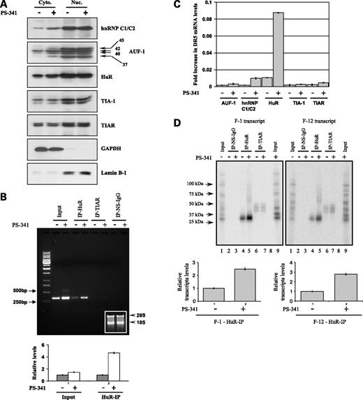 Figure 5. Analysis of RNA-binding proteins in LNCaP cells treated with PS-341. A, Western blot analysis of cytoplasmic (Cyto) and nuclear extracts (Nuc) prepared from vehicle or PS-341-treated (0.5 μmol/L, 18 h) LNCaP cells. Cytoplasmic extracts (30 μg) and nuclear extracts (10 μg) were run on 12% SDS-PAGE, transferred to polyvinylidene difluoride membrane, and probed with antibodies to specific RNA-binding proteins. GAPDH was used as a loading control for the cytoplasmic extract, and Lamin B1 was a control for equivalent loading of nuclear proteins. B, PCR analysis of endogenous DR5 mRNA after immunoprecipitation of mRNA-binding proteins. Cytoplasmic extracts prepared from vehicle or PS-341-treated (500 nmol/L, 18 h) LNCaP cells were incubated with monoclonal HuR antibody, monoclonal TIAR antibody, or nonspecific IgG-coated protein A beads and immunoprecipitated in RNase-free conditions. RNA extracted from the immunoprecipitated complex was subjected to reverse transcription and PCR for 25 cycles. Bottom, bar graph of the relative RNA levels. Experiments were repeated in triplicate and the mean ± SD is plotted. To establish equivalent levels of RNA in the samples, total RNA extracted from the cytoplasmic extracts was run on 1% formaldehyde agarose gel and ribosomal bands were photographed (see inset, lane 1 for vehicle and lane 2 for PS-341 treated). C, quantitative real-time PCR analysis of endogenous DR5 mRNA immunoprecipitated with various mRNA-binding proteins. Immunoprecipitation was carried out on extracts generated as described in B. The RNA extracted from the immunoprecipitated complex was reverse transcribed and subjected to quantitative real-time PCR analysis. The cytoplasmic extracts (input) are shown. Columns, fold increase in DR5 mRNA immunoprecipitated. The experiments were repeated in triplicate and the mean ± SD is plotted. D, autoradiographic images of experiments carried out in a similar fashion to B using in vitro transcribed and radiolabeled F-1 and F-12 transcripts. LNCaP cells were treated with DMSO or PS-341 (500 nmol/L, 18 h) and UV cross-linked with F-1 and F-12 transcripts. RNA-binding proteins were immunoprecipitated with HuR or TIAR antibodies or nonspecific IgG. After immunoprecipitation, the complexes were separated via 10% SDS-PAGE and subjected to phosphorimaging. One tenth of the samples used for immunoprecipitation was loaded in lanes 1 and 9 without immunoprecipitation. Bottom, quantitative representation of the radioactivity in the transcripts immunoprecipitated with HuR antibody. The experiments were repeated in triplicate and the mean ± SD is plotted.