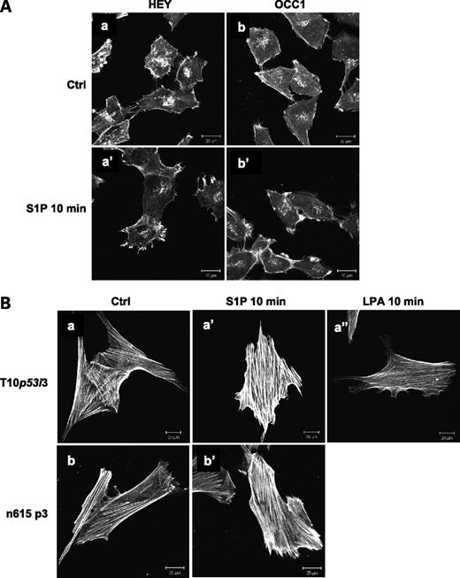 Figure 4. Cell morphology of EOC and HOSE cells and response to S1P treatment. Two EOC cells (HEY and OCC1; A) and two HOSE cells (T103p53i and n615 p3; B) were plated onto glass slides and treated with or without S1P (0.5 μmol/L) or LPA (5 μmol/L) for 10 min as indicated and then F-actin was stained with TRITC-phalloidin. Representative images of two independent experiments.