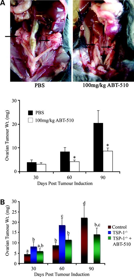 Figure 1. A, ABT-510 inhibits ovarian tumor formation. Ovarian tumor formation was induced by injecting 1 × 106 spontaneously transformed murine ovarian surface epithelial cells under the ovarian bursa of both ovaries of syngeneic C57BL/6 mice. In PBS-treated animals, large bilateral primary tumors were evident at 90 d post-tumor induction, whereas 100 mg/kg ABT-510 significantly decreased the size of ovarian masses. Ovarian tissue was collected at 30, 60, and 90 d post-tumor induction and ABT-510 significantly reduced ovarian tumor weight at 60 and 90 d compared with PBS-treated controls. (n = 5 mice per group). *, P < 0.05, statistical difference between PBS-treated and ABT-510-treated groups. B, ovarian tumors grow larger in mice lacking TSP-1. There was a significant increase in ovarian tumor weight in TSP-1−/− mice at 30 and 60 d post-tumor induction (blue columns) compared with wild-type controls (red columns). Before 90 d post-tumor induction, TSP-1−/− animals had to be euthanized due to morbidity. The addition of ABT-510 (green columns) significantly reduced ovarian tumor size in TSP-1−/− mice, increasing their survival time to beyond 90 d post-tumor induction (n = 5 animals per group). Columns with different letters are statistically different (P < 0.05).