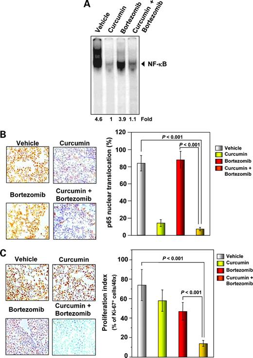 Figure 5. Curcumin enhances the inhibitory effect of bortezomib on the activation of NF-κB and expression of the cell proliferation marker Ki-67 in multiple myeloma tumor samples. A, EMSA analysis revealed that curcumin inhibited NF-κB activation in nuclear extracts from animal tissue. B, left, immunohistochemical analysis of nuclear p65 in tumor tissues showed that curcumin alone and in combination with bortezomib inhibited NF-κB activation. B, right, quantification of NF-κB expression in multiple myeloma tumor samples. Percentages indicate p65 nuclear positive cells. Samples from three animals in each treatment group were analyzed. Representative data. C, left, immunohistochemical analysis of Ki-67-positive cells in multiple myeloma indicated that curcumin alone and in combination with bortezomib suppressed cell proliferation. Samples from three animals in each treatment group were analyzed. Representative data. C, right, quantification of Ki-67 proliferation index as described in Materials and Methods. Mean ± SE of triplicate.