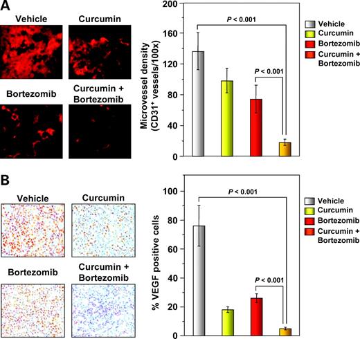 Figure 6. Curcumin enhances effects of bortezomib to inhibit angiogenesis in multiple myeloma tumor samples. A, left, immunohistochemical analysis of the microvessel density marker CD31 in multiple myeloma tumor samples. Samples from three animals in each treatment group were analyzed. Representative data. A, right, quantification of CD31+ microvessel density as described in Materials and Methods. Mean ± SE of triplicate. B, left, immunohistochemical analysis of VEGF in multiple myeloma tumor samples revealed that curcumin alone and in combination with bortezomib suppresses angiogenesis. Samples from three animals in each treatment group were analyzed. Representative data. B, right, quantification of VEGF as described in Materials and Methods. Mean ± SE of triplicate.