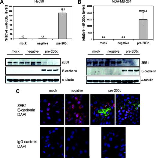 Figure 2. Addition of exogenous miR-200c results in repression of ZEB1 and restoration of E-cadherin protein. Hec50 endometrial cancer cells (A) and MDA-MB-231 breast cancer cells (B) were treated with transfection reagent only (mock), scrambled negative control mimic (negative), or miR-200c mimic (pre-200c). After 48 h, RNA was harvested and miR-200c levels were determined by real-time PCR (top). Columns, mean of quadruplicate samples; bars, SE. The miR-200c levels are normalized to rRNA and are relative to mock transfection levels. Western blots of protein from the three experimental groups (mock, negative, or miR-200c treated) were probed for ZEB1, E-cadherin, and α-tubulin as a loading control. Three replicates per treatment group are shown. For both real-time RT-PCR and Western blots, results are representative of one of three independent experiments. C, Hec50 cells grown on coverslips were treated as above and fluorescent immunocytochemistry results using antibodies recognizing ZEB1 (red), E-cadherin (green), and 4′,6-diamidino-2-phenylindole (DAPI; blue) are shown merged. Bottom, relevant IgG-negative controls. Magnification, ×1,000.