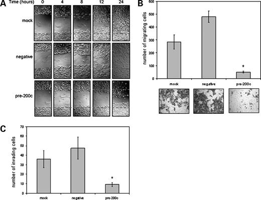 Figure 3. Restoration of miR-200c expression in Hec50 decreases migration and invasion. A, Hec50 cells were treated with transfection reagent only, a scramble negative control, or miR-200c mimic. After 48 h, wounds were inflicted and pictures taken at 0, 4, 8, 12, and 24 h after wounding. Lines indicate width of the wound at time zero. Pictures shown are from one experiment representative of three separate experiments (not shown). B, mock-, negative-, or miR-200c–transfected cells were subjected to a transwell migration assay. After 48 h, cells on the bottom side of the membrane were stained and mounted onto slides and the mean number of cells in four fields of vision on a cross-hatch was counted with error bars representing SE of four replicates. *, statistically significant difference between the numbers of cells migrating in the pre-200c, compared with either mock-transfected cells or negative control–treated cells [P = 2.8 × 10−4 and P = 6.0 × 10−8, respectively (Student's t test)]. Representative images (×100 magnification) of stained filters are shown. C, the number of cells able to invade through Matrigel-coated Boyden chambers was also determined for each group. Columns, mean number of cells from four replicates; bars, SE. *, statistically significant difference between the pre-200c–treated group, compared with either mock-transfected cells or negative control–treated cells [P = 0.0039 and P = 0.0020, respectively (Student's t test)].