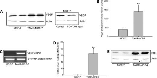 Figure 1. Increased VEGF production in TAMR-MCF-7 cells. A, immunoblot analysis of VEGF protein. Left, MCF-7 and TAMR-MCF-7 cells were incubated in serum-free medium for 18 h and the intracellular VEGF protein levels were monitored in the cell lysates. Each lane represents cells of different passage. Right, MCF-7 cells were incubated with vehicle or 4-hydroxytamoxifen (4-OHTAM; 3 μmol/L) for 24 h and the intracellular VEGF protein levels were monitored in the cell lysates. Each lane was loaded with 15 μg of protein. B, MCF-7 and TAMR-MCF-7 cells were incubated in serum-free medium for 24 h and the culture media (50 μL) were subjected to VEGF ELISA. Columns, mean (n = 4); bars, SE. **, P < 0.01, compared with control MCF-7 cells. MCF-7 cells exposed to hypoxia for 24 h were used as a positive control for VEGF production. C, VEGF mRNA. RT-PCR was done with 1 μg total RNA prepared from MCF-7 and TAMR-MCF-7 cells. D, transcriptional regulation of VEGF gene. MCF-7 and TAMR-MCF-7 cells were incubated in serum-free medium for 18 h after transfection of VEGF-Luc gene, and dual-luciferase reporter activities were measured using cell lysates. Columns, mean (n = 6); bars, SD. **, P < 0.01, compared with control MCF-7 cells. E, ERα expression in TAMR-MCF-7 cells. Immunoblot analysis of ERα protein was done using 15 μg of total cell lysates. Each lane represents cells of different passage.