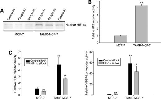 Figure 2. Partial role of HIF-1α activation in the enhanced VEGF expression in TAMR-MCF-7 cells. A, the expression levels of HIF-1α were monitored in the nuclear fractions obtained from both MCF-7 and TAMR-MCF-7 cells. Each lane was loaded with 10 μg of nuclear protein. B, HRE minimal reporter activity. MCF-7 and TAMR-MCF-7 cells were incubated in serum-free medium for 18 h after transfection of HRE-Luc gene. Columns, mean (n = 6); bars, SD. **, P < 0.01, compared with MCF-7 cells. C, effect of HIF-1α siRNA on VEGF gene transcription in TAMR-MCF-7 cells. TAMR-MCF-7 cells were cotransfected with HRE-Luc (left) or VEGF-Luc reporter plasmid (right) in combination with HIF-1α siRNA (20 pmol) or control siRNA. Columns, mean (n = 5–6); bars, SD. **, P < 0.01, compared with MCF-7 cells. #, P < 0.05; ##, P < 0.01, compared with the control siRNA group.
