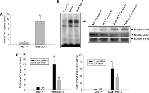 Figure 3. Role of AP-1 activation in the enhanced VEGF expression in TAMR-MCF-7 cells. A, AP-1 minimal reporter activity. MCF-7 and TAMR-MCF-7 cells were incubated in serum-free medium for 18 h after transfection of pAP-1-Luc reporter gene. Columns, mean (n = 6); bars, SD. **, P < 0.01, compared with MCF-7 cells. B, AP-1 DNA binding and nuclear levels of AP-1 proteins. AP-1 DNA binding was determined by gel-shift analysis (left). All lanes contained 15 μg of nuclear extracts and 5 ng of the labeled AP-1 consensus sequence. Competition studies were carried out by adding a 10-fold excess of unlabeled AP-1 consensus oligonucleotide to the nuclear extracts of TAMR-MCF-7 cells. Nuclear fractions were obtained from both MCF-7 and TAMR-MCF-7 cells serum starved for 18 h, and c-Jun, JunB, and c-Fos were immunoblotted with the specific antibodies (right). Each lane was loaded with 10 μg of nuclear protein. C, effects of c-Jun siRNA on the activities of AP-1 minimal reporter and VEGF reporter. MCF-7 and TAMR-MCF-7 cells were cotransfected with pAP-1-Luc reporter (left) or VEGF-Luc reporter (right) in combination with c-Jun siRNA (20 pmol) or control siRNA. Columns, mean of six different samples; bars, SD. **, P < 0.01, compared with MCF-7 cells. #, P < 0.05; ##, P < 0.01, compared with the control siRNA group.