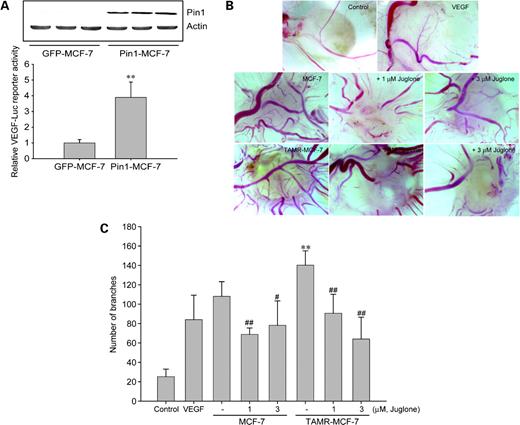 Figure 5. Essential role of Pin1 in the VEGF-dependent enhanced angiogenic intensity in TAMR-MCF-7 cells. A, increased VEGF gene transcription in stably Pin1-overexpressing MCF-7 cells. GFP-MCF-7 and Pin1-MCF-7 cells were transfected with VEGF-Luc and dual-luciferase reporter activities were measured using cell lysates (bottom). Columns, mean of six different samples; bars, SD. **, P < 0.01, compared with control. Pin1 expression was confirmed by Western blot analysis (top). B, representative pictures of angiogenesis originated from both MCF-7 and TAMR-MCF-7 cells. The control CAMs of a 10-d-old chick embryo were exposed to PBS or VEGF (20 ng/mL). The additional embryos were implanted with MCF-7 or TAMR-MCF-7 (2 × 106 cells/CAM). MCF-7 cells and TAMR-MCF-7 cells were not exposed to VEGF. C, the quantitation of new branches formed from existing blood vessels was done 3 d after cancer cell implantation. Columns, mean (n = 5–7); bars, SD. **, P < 0.01, compared with the MCF-7 cell–implanted group. #, P < 0.05, ##, P < 0.01, compared with the vehicle-treated MCF-7 or TAMR-MCF-7 group. The CAM assays were repeated twice and similar results were obtained.