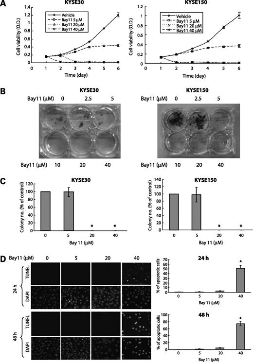 Figure 2. Effects of Bay11 on esophageal cancer cell growth and death. A, MTT assay was used to determine the effects of Bay11 on the viability of the esophageal cancer cell lines KYSE30 and KYSE150. Note that exposure of the cells to 20 and 40 μmol/L Bay11 completely abrogated cell viability within 2 d, whereas 5 μmol/L of Bay11 significantly reduced cell viability after 72-h treatment (P < 0.001). B and C, colony formation assay and soft agar assay, respectively, showed that high concentrations of Bay11 (20 and 40 μmol/L) significantly decreased both anchorage-dependent and anchorage-independent colony formation ability of KYSE30 and KYSE150 cells, whereas treatment of the cells with a low concentration of Bay11 (5 μmol/L) for only 24 h did not affect anchorage-independent growth in soft agar. D, representative TUNEL-stained images (left) and apoptotic indices of KYSE30 cells treated with 5, 20, or 40 μmol/L Bay11, or DMSO control for 24 or 48 h. Treatment with 40 μmol/L Bay11 significantly increased the apoptotic index at both time points. Bars, SD; *, P < 0.001.