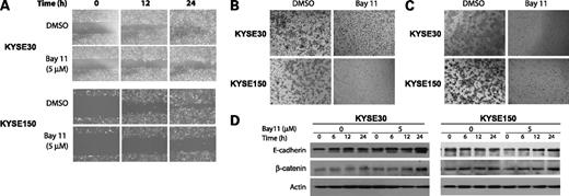 Figure 4. Effects of Bay11 on esophageal cancer cell migration and invasion. Treatment of KYSE30 and KYSE150 cells with Bay11 (5 μmol/L) reduced the migration and invasion potential as determined by wound-healing assay (A), cell migration assay (B), and cell invasion assay (C). D, Western blot analysis of protein expressions of E-cadherin and β-catenin in KYSE30 and KYSE150 cells treated with Bay11 (5 μmol/L) for the indicated time points. Actin was included as internal loading control. The expression levels of E-cadherin and β-catenin were increased after treatment with Bay11 for 24 h compared with the cells treated with vehicle control (DMSO).