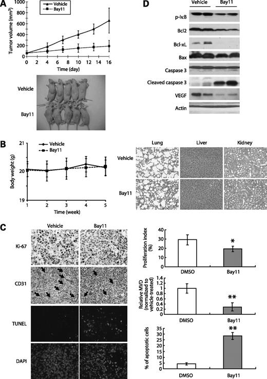 Figure 5. Effects of Bay11 on suppressing growth of human esophageal cancer xenograft in nude mice. A, growth curves and representative photograph of s.c. tumors in nude mice treated with Bay11 or DMSO. The mice bearing KYSE30 xenografts received 5 mg/kg Bay11 (n = 9) or DMSO (n = 9) through i.p. injection thrice per week. B, comparison of body weight of Bay11-treated mice, and histologic examination of lung, liver, and kidney specimens (H&E stained) with that of DMSO-treated control animals indicated no toxic effects C, Ki-67, CD31 immunostaining, and TUNEL staining of tumor xenografts from the mice treated with Bay11 or DMSO (left); tumor proliferation index, tumor microvessel density (MVD), and apoptosis index (right). Bars, SD; *, P < 0.005; **, P < 0.001 compared with DMSO-treated mice. D, Western blot analysis showed decreased expression of p-IκB, Bcl2, Bcl-xL, and vascular endothelial growth factor (VEGF), as well as increased cleaved caspase-3 in the Bay11-treated tumor xenografts, compared with the DMSO-treated tumor xenografts.