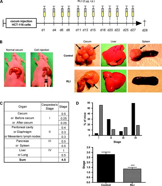 Figure 5. Therapy of HCT-116 human colon cancer cells implanted in the cecum of nude mice. A, schematic of the RLI treatment in mice injected with 1 × 106 HCT-116 cells into the cecal wall. Nude mice received one i.p. injection of RLI (2 μg) or saline (control) at day 1 and thrice per week for 28 d. B, left, representative pictures of cecum before or during HCT-116 cell injection in the cecum of nude mice; right, metastasis (arrows) in cecum, liver, or spleen of control and RLI-treated mice. C, definition of tumor staging 28 d after HCT-116 cell injection: column 2, according to Cespedes et al.; column 3, according to our tumor staging. D, development stages of HCT-116 tumors after treatment with RLI (checkered columns) or vehicle (black columns; n = 27 for each group). Top, tumor staging (% of mice) according to Cespedes et al.; bottom, quantification of local tumor and dissemination pattern. ***, P < 0.001 versus control, Dunnett's multiple comparison test.