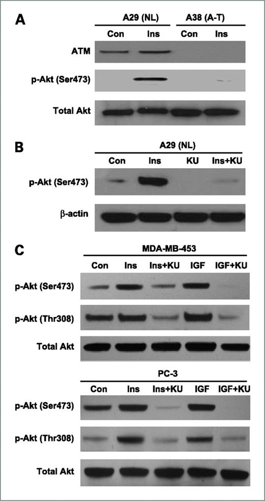 Figure 1. A, comparison of Akt phosphorylation at Ser473 in normal (A29; ATM+/+) and A-T (A38; ATM−/−) MEF cells treated with insulin. Subconfluent cells were starved overnight and were treated with or without 100 nmol/L insulin for 45 min. Cells were then lysed and protein samples were subjected to SDS-PAGE and Western blotting as described in Materials and Methods. ATM, phospho-Akt at Ser473, and total Akt were detected by their respective antibodies. B, KU-55933 inhibits phosphorylation of Akt at Ser473 in A29 cells. Subconfluent A29 cells were serum starved overnight. Cells were then treated with KU-55933 (10 μmol/L) for 1 h before the addition of 100 nmol/L insulin for another 45 min. Cells were then lysed, and protein samples were subjected to SDS-PAGE and Western blotting as described above. Phospho-Akt at Ser473 and β-actin were detected. C, KU-55933 inhibits the phosphorylation of Akt in MDA-MB-453 and PC-3 cells. Subconfluent cells were serum-starved for 24 h. They were then treated with KU-55933 (10 μmol/L) for 1 h before the addition of insulin (100 nmol/L) or IGF-I (50 ng/mL) for another 45 min. Cells were then lysed and protein samples were subjected to SDS-PAGE and Western blotting. The membranes were immunoblotted with antibodies against phospho-Ser473 and phospho-Thr308 of Akt and total Akt, respectively. The results presented in A to C are representative of three individual experiments.
