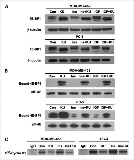 Figure 4. KU-55933 (KU) inhibits 4E-BP1 phosphorylation and cyclin D1 translation. A, subconfluent MDA-MB-453 and PC-3 cells were starved for 24 h and then treated with KU-55933 (10 μmol/L) for 1 h before the addition of insulin (Ins; 100 nmol/L) and IGF-I (50 ng/mL) for 45 min. 4E-BP1 and β-tubulin were detected. Con, control. B, cell lysates obtained from the above treatments were mixed with M7GTP-Sepharose beads overnight at 4°C. eIF-4E and 4E-BP1 pulled down by the beads were detected by immunoblotting. C, after 1 h of pretreatment with KU-55933 and 45 min of insulin stimulation as described above, cells were labeled with S35-Methionine for 1 h. Immunoprecipitated cyclin D1 was subjected to SDS-PAGE and incorporation of S35-Methionine was determined by autoradiography. The results in A to C are representative of three individual experiments.