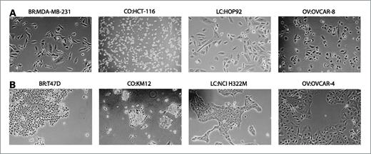 Figure 3. Variations in cell-cell adhesion as observed by phase contrast microscopy. A, cells with undetectable levels of E-cad expression (<5.40 units on HG-U133 arrays; Table 1). B, cells with detectable levels of E-cad (≥5.4 units on HG-U133 arrays; Table 1).