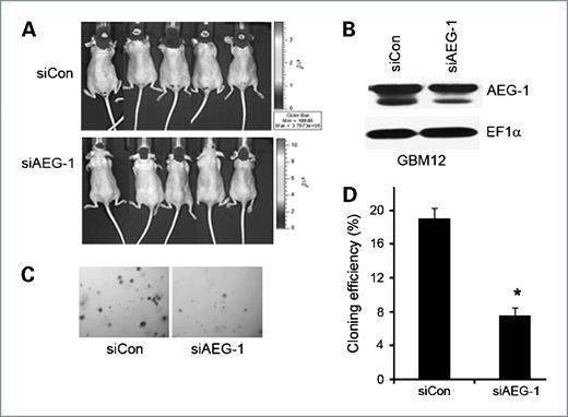 Figure 6. Knockdown of AEG-1 in GBM12 cells reduces intracranial tumor growth in vivo. A, GBM12 cells stably transfected with a plasmid expressing luciferase transduced with lentivirus expressing control siRNA (siCon) or AEG-1 siRNA (siAEG-1) were implanted into athymic nude mice brains. Animals were injected i.p. with 175 mg/kg luciferin 21, 28, and 42 d after GBM12 cell implantation and light emanating from the implanted tumors visualized in a CCD camera apparatus with software 5 min after injection for 10 min. B, knockdown of AEG-1 in lentivirus-AEG-1 siRNA–transduced GBM12 cells. EF1α was used as an internal control to ascertain equal loading. C and D, cloning efficiency of GBM12 cells treated with lentivirus-control siRNA or lentivirus-AEG-1 siRNA. A total of 1 × 105 cells were seeded in 0.4% agar on 0.8% base agar. Two weeks later, colonies of >0.1 mm were counted under a dissection microscope. *, P < 0.05 versus lentivirus-control siRNA–treated cells.