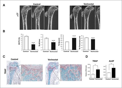 Figure 5. Vorinostat reduces trabecular bone mass in non–tumor-bearing animals by stabilizing osteolytic factors. A, femurs of non–tumor-bearing animals after 4 weeks of daily vorinostat injections. B, quantitation of trabecular bone parameters on femurs of non–tumor-bearing animals treated with vorinostat or DMSO control (n = 6; ***P < 0.001). Trabecular region analyzed is 1 to 2 mm from distal growth plate, and cortical analysis is at 5.5 mm. C, right panels, tartrate-resistant acid phosphatase histochemistry for the detection of osteoclasts. D, relative mRNA levels of TRAP and ALKP in bone extracts treated with vorinostat or vehicle as examined by real-time PCR analysis (n = 3; *P < 0.05).
