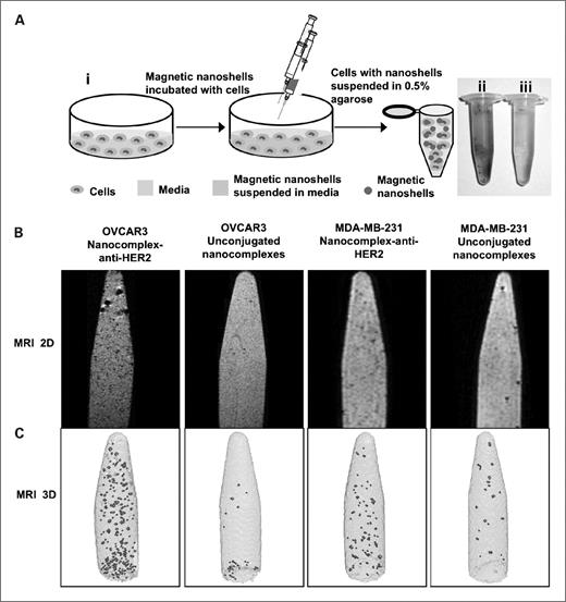 Figure 3. A, i, schematic representation of sample preparation for in vitro magnetic resonance imaging studies. Magnetic nanocomplexes are incubated with cells, washed after 2 h, centrifuged, and suspended in 0.5% agarose. Optical image of cells with nanocomplex–anti-HER2 conjugates suspended in agarose (ii) and cells with control unconjugated nanocomplexes suspended in agarose (iii). B, two-dimensional magnetic resonance image of HER2-positive OVCAR3 cells and low HER2 expression MDA-MB-231 suspended in 0.5% agarose with nanocomplex–anti-HER2 conjugates with ∼0.215 mmol/L Fe3O4 and control unconjugated nanocomplexes. MRI, magnetic resonance imaging. C, maximum intensity projection of 128 × 128 × 64 pixel threshold T2 maps of the images corresponding to the two-dimensional magnetic resonance images. The hypointense signals observed in the two- and three-dimensional images are the cells labeled with the magnetic nanocomplexes.