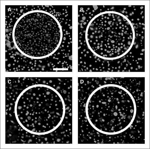 Figure 4. Photothermal ablation and live/dead stain of OVCAR3 cells incubated with nanocomplex–anti-HER2 conjugates (A) and control unconjugated nanocomplexes (B) and treated with near-IR laser at 808 nm for 10 min at a power density of 5.81 W/cm2 and spot size of ∼0.8-mm diameter. Live cells are stained green with calcein and dead cells are stained red with propidium iodide. Similar staining procedure for MDA-MB-231 cells incubated with nanocomplex–anti-HER2 conjugates (C) and control (D) and treated with near-IR laser as well. Original magnification, ×100. Scale bar, 250 μm for all panels.
