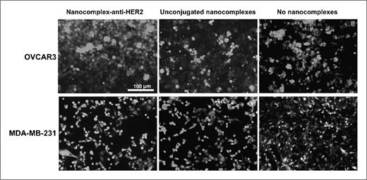 Figure 5. Absence of cytotoxicity on OVCAR3 cells incubated with nanocomplex–anti-HER2 conjugates, unconjugated nanocomplexes, and control (no nanocomplexes) are in the top row. MDA-MB-231 cells incubated with nanocomplex–anti-HER2 conjugates, unconjugated nanocomplexes, and controls are in the bottom row. Live cells are stained green with calcein, and dead cells are stained red with propidium iodide. Original magnification, ×200. Scale bar, 100 μm for all panels.