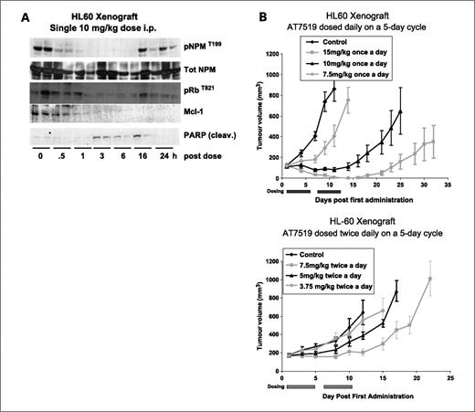 Figure 2. AT7519 is efficacious in animal models of leukemia. Nude mice bearing HL60 xenograft tumors were given a single i.p. dose of AT7519 at 10 mg/kg (A). Tumors were removed at various times after administration of AT7519 and prepared for western blotting with the indicated antibodies. Data shown are representative of two independent experiments done in duplicate. HL60 tumor–bearing mice received AT7519 or vehicle control either once or twice daily i.p. at the indicated doses for two 5-day cycles. Tumor volumes were recorded every 3 days (B).