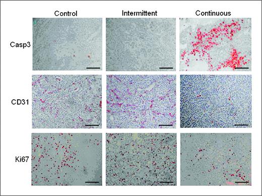 Figure 4. Representative tumor sections following immunohistochemistry, illustrating the effects of intermittent and continuous DTX treatment on tumor apoptosis (Casp3), angiogenesis (CD31), and proliferation (Ki67) on day 24 postinoculation (x100 magnification; scale bars, 10 μm).