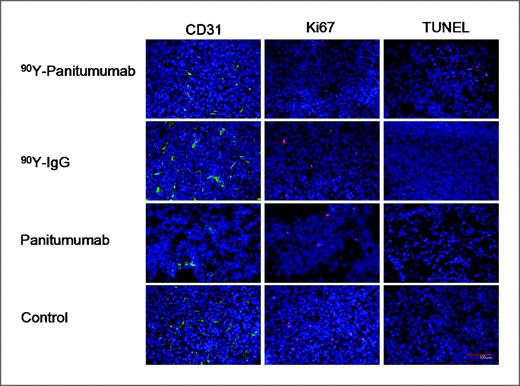 Figure 6. Immunofluorescence staining of CD31, Ki67, and TUNEL for UM-SCC-22B tumor tissues from groups treated with 90Y-DOTA-panitumumab (3.7 MBq), 90Y-DOTA-IgG (3.7 MBq), panitumumab, and saline (control). Scale bar, 100 μm.